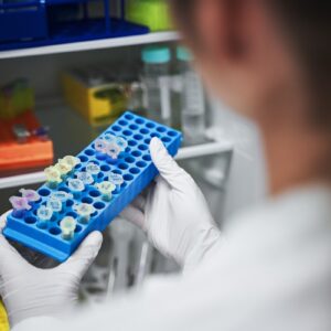 Gestion des échantillons stockés dans le froid (azote liquide / -80°C / -20°C)